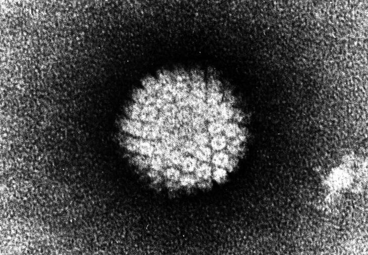 Human papillomavirus causing skin lesions